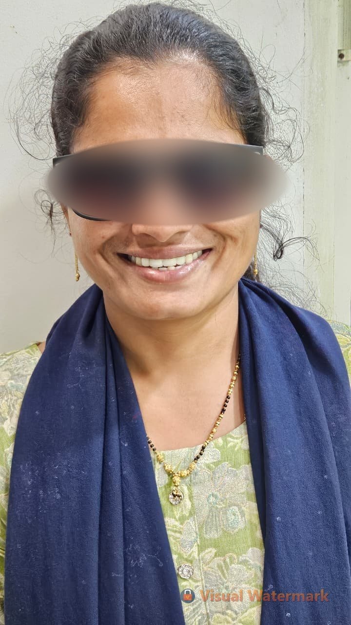 Dental treatment after — patient 12 smile transformation at Durge Dental Mancherial