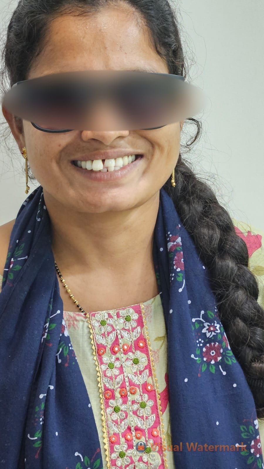 Dental treatment before — patient 12 at Durge Dental Clinic Mancherial