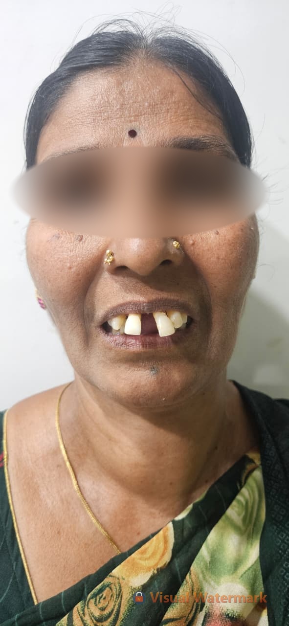 Patient 6 before