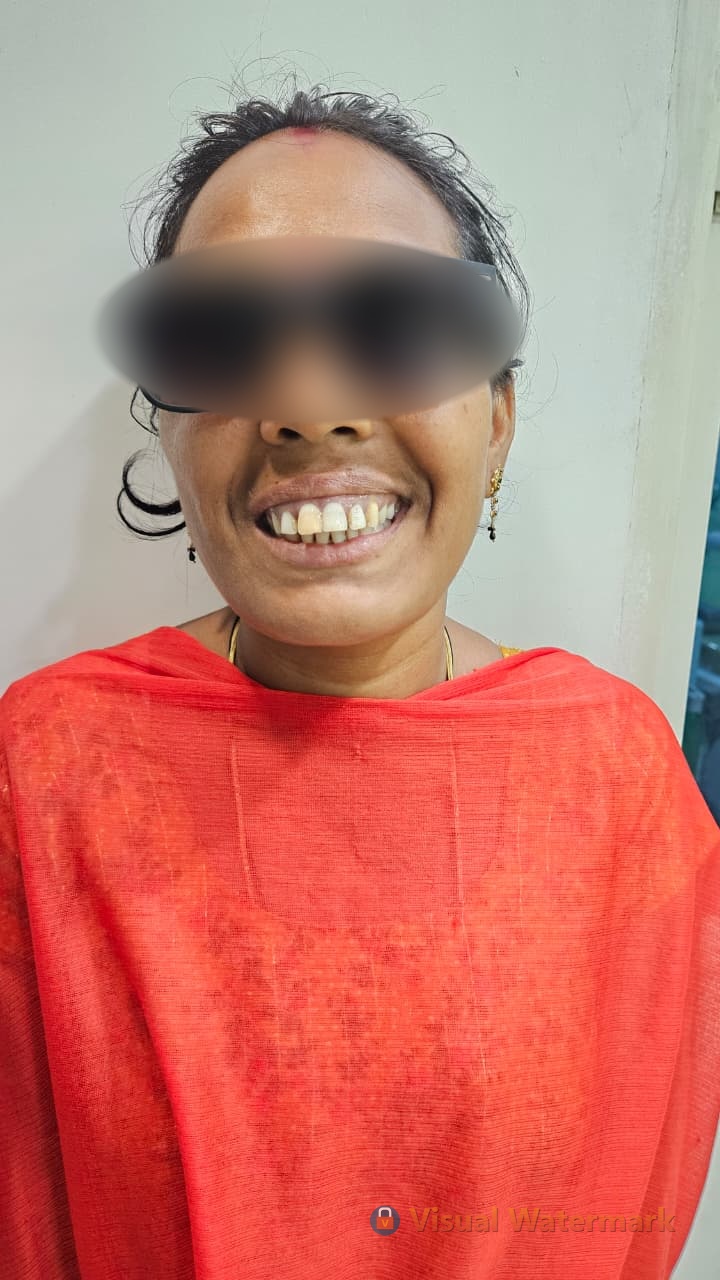 Dental treatment after — patient 3 smile transformation at Durge Dental Mancherial