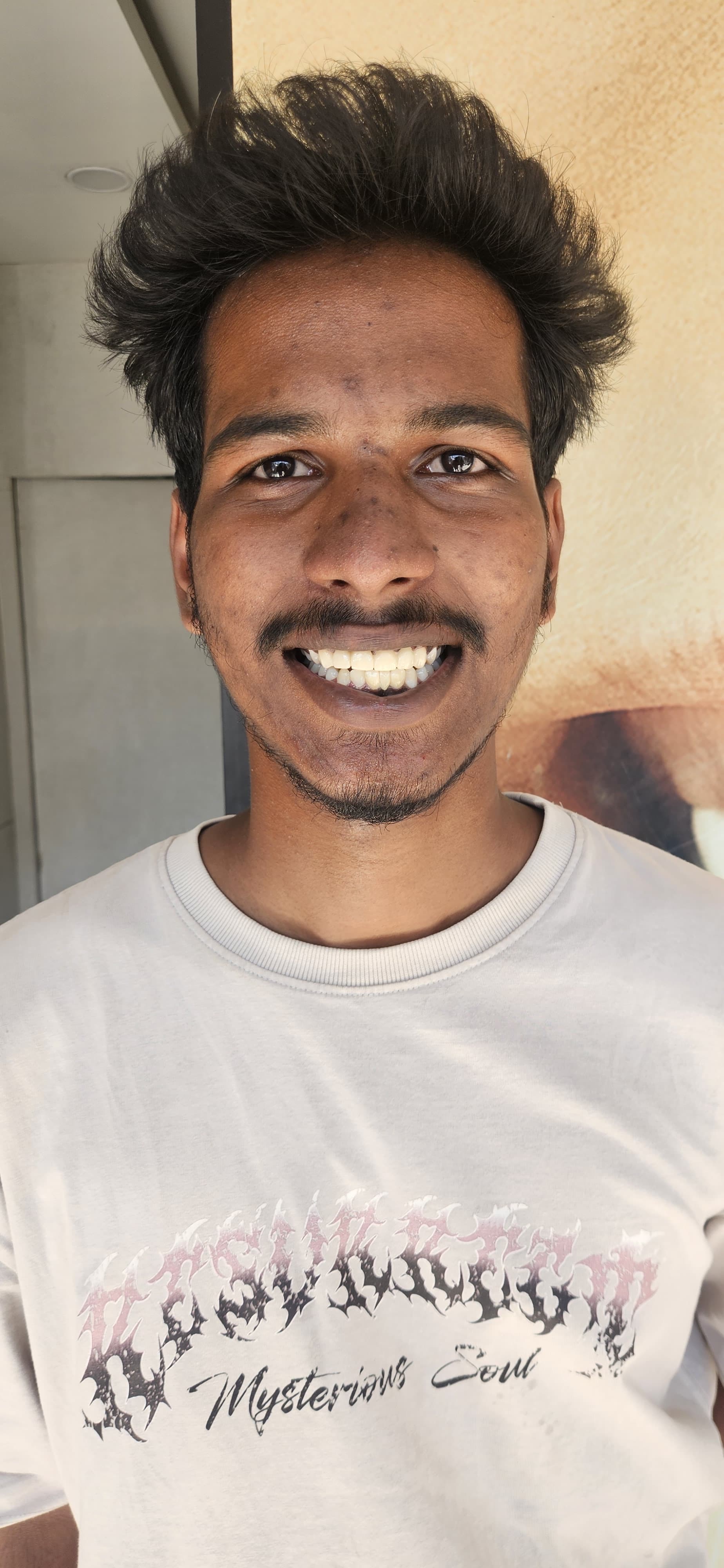 Dental treatment after — patient 4 smile transformation at Durge Dental Mancherial