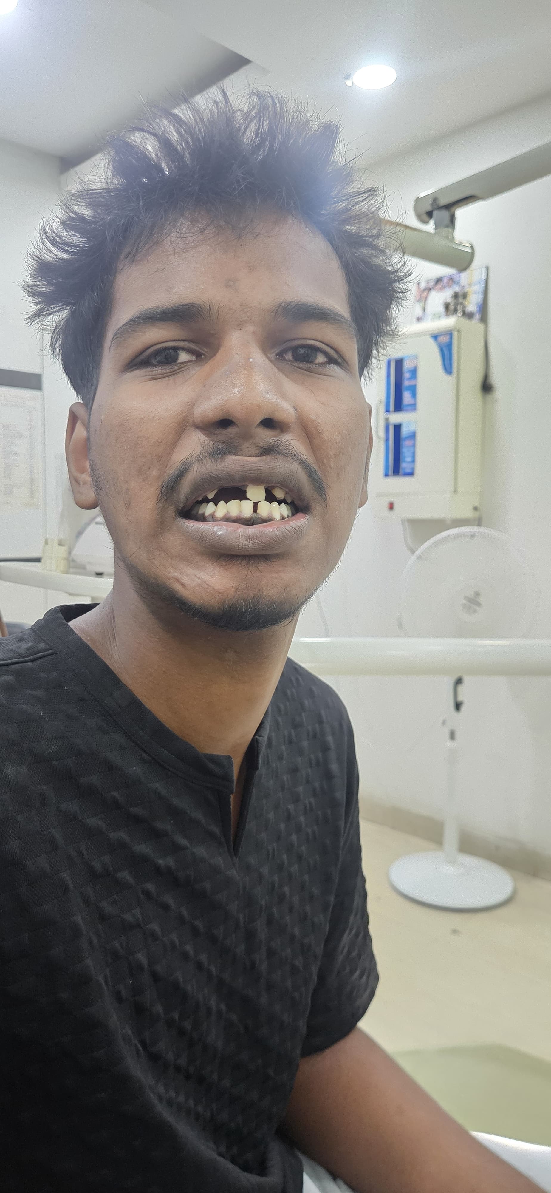 Dental treatment before — patient 4 at Durge Dental Clinic Mancherial